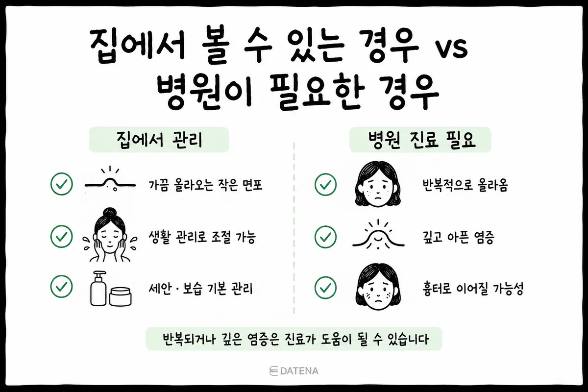 Checklist: treating acne at home vs. seeing a dermatologist. Mild comedones can be managed at home; recurring, painful inflammation calls for a clinic visit