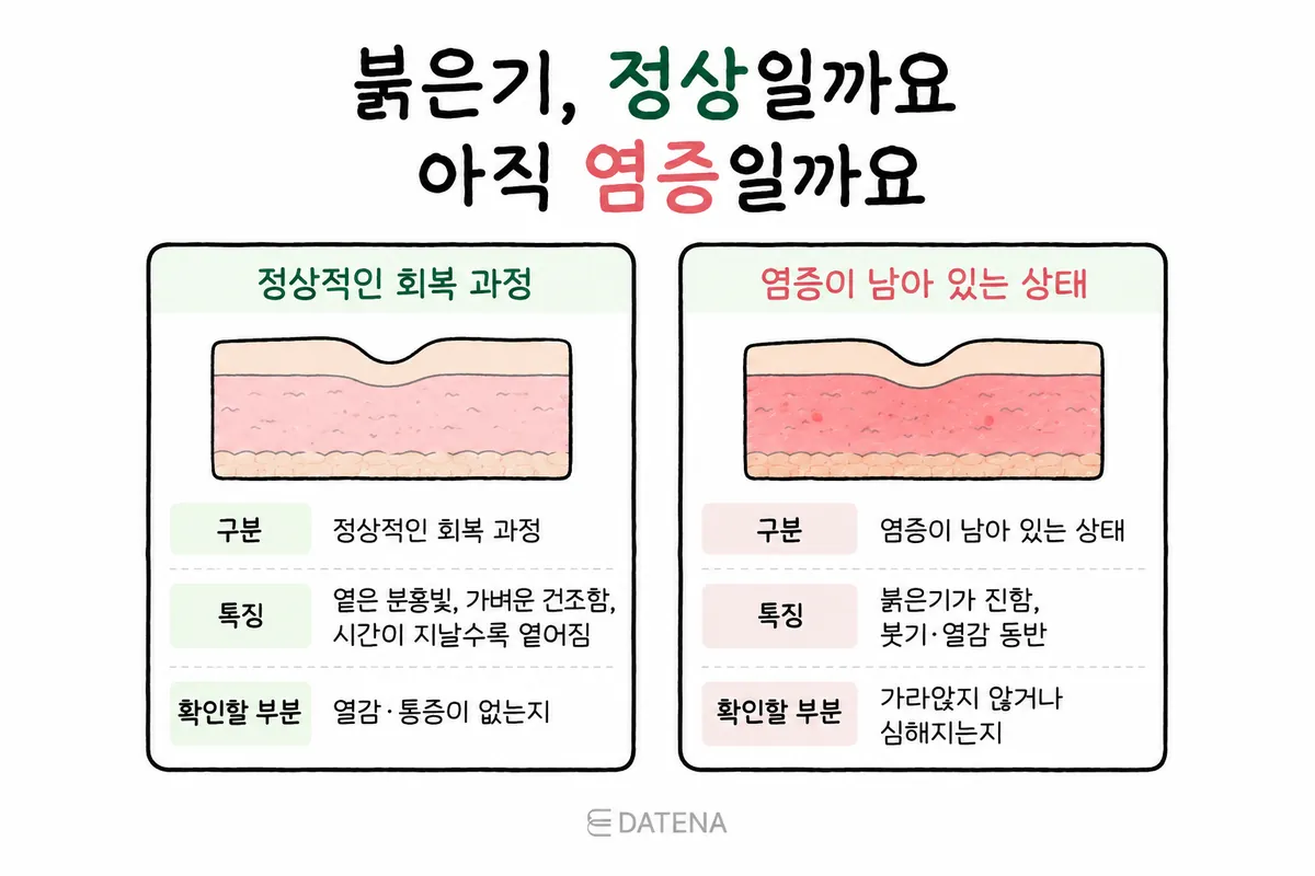 Illustration comparing fading redness with redness accompanied by swelling and warmth